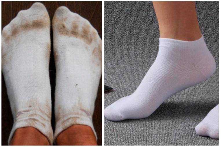 В этой статье расскажем, как правильно и быстро стирать цветные, белые, шерстяные носки в домашних условиях: в стиральной машине, в мешке для стирки, как избавиться от грязи и черной подошвы при помощи народных средств, с чем можно и нельзя