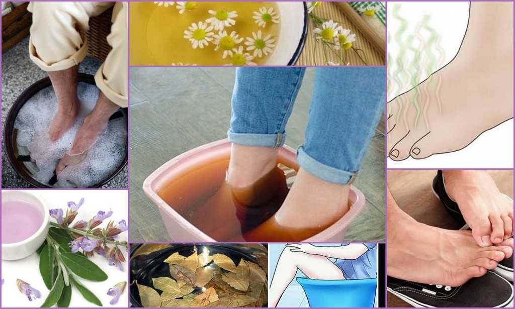 Как убрать запах из обуви: 50 лучших средств и методов для избавления от вони в домашних условиях