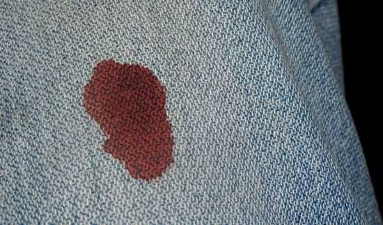 Из этой статьи вы узнаете, как эффективно отстирать свежее и застарелое пятно крови на джинсах, используя проверенные народные рецепты и средства бытовой химии