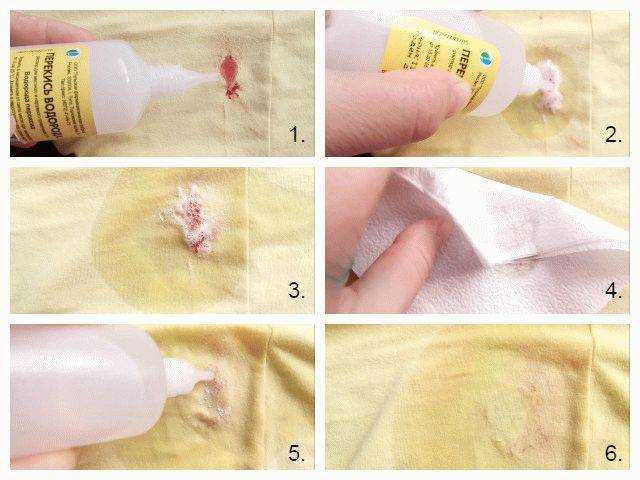 Как отстирать кровь с белой одежды, чем вывести пятна с ткани, как удалить кровь с одежды
