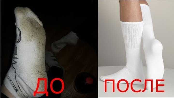 Носки – одни из самых популярных предметов гардероба, попадающих под сильный удар грязи, пыли и других загрязнений Что делать, если белые или цветные носки