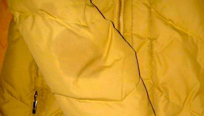 Как вывести желтые пятна с белой одежды народными средствами и бытовой химией